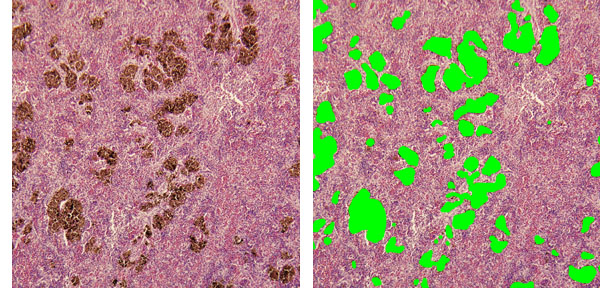 macrophage areas method